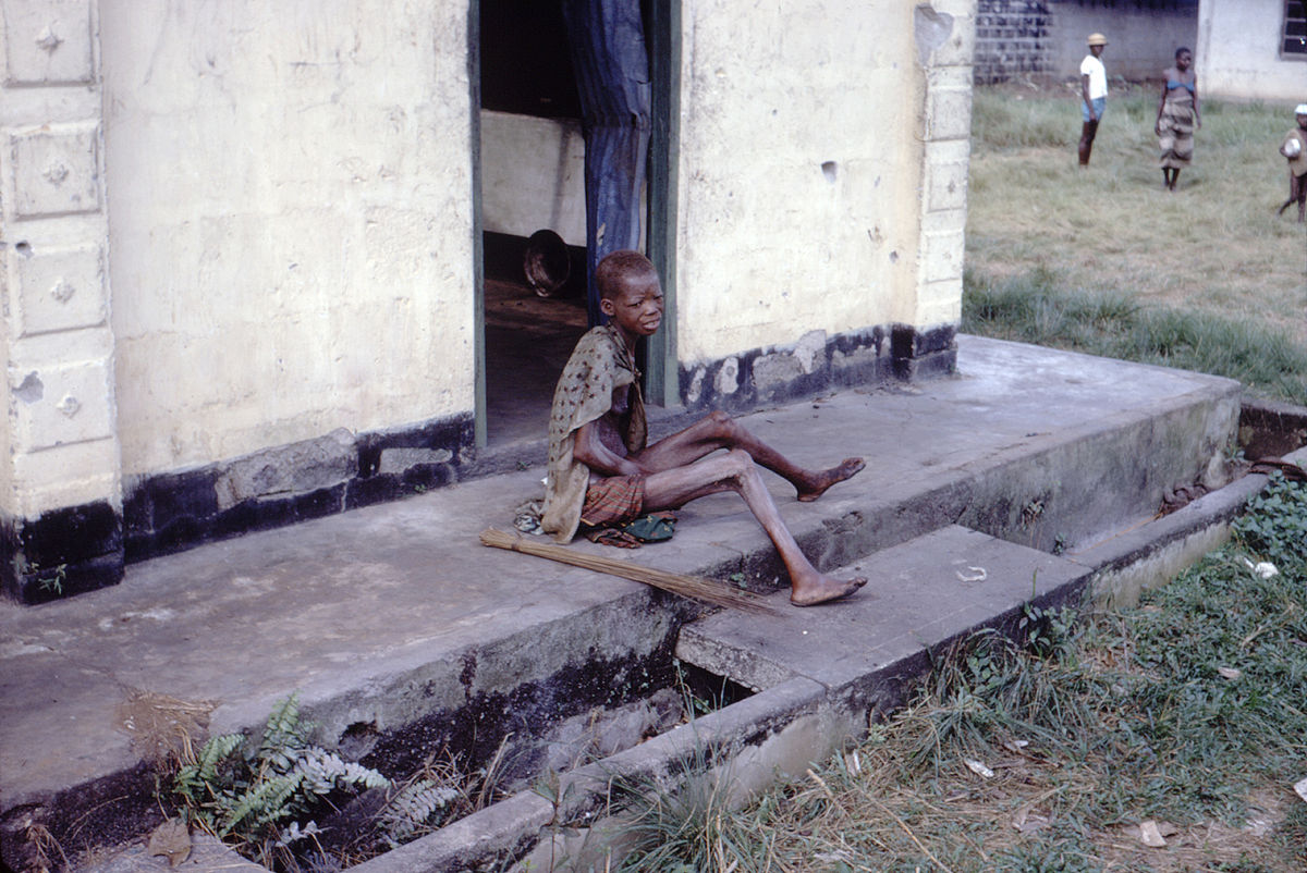 1200px-starving-woman-africa-biafra-nigeria-conflict-famine